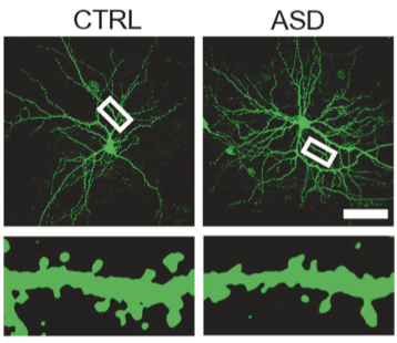 Astrocyte signaling